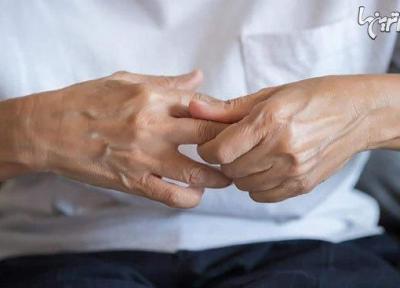 آرتروز چیست و چه علائمی دارد؟
