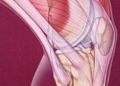 چرا عضلات می گیرند؟